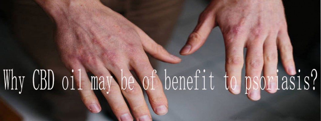 WHY CBD OIL MAY BE OF BENEFIT TO PSORIASIS WHY CBD OIL MAY BE OF BENEFIT TO PSORIASIS