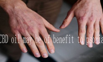 POURQUOI L'HUILE DE CBD PEUT ÊTRE BÉNÉFIQUE POUR LE PSORIASIS POURQUOI L'HUILE DE CBD PEUT ÊTRE BÉNÉFIQUE POUR LE PSORIASIS