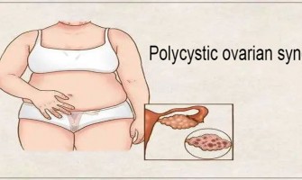 Does NMN help PCOS? Does NMN help PCOS?