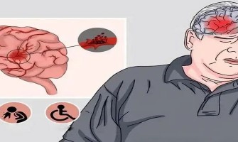 NMN: A Cardiovascular Solution NMN: A Cardiovascular Solution