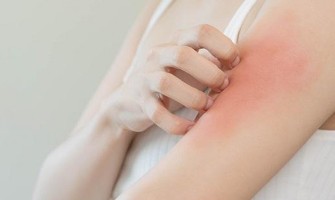 NMN May Introduce New Feature for Allergy Sufferers NMN May Introduce New Feature for Allergy Sufferers