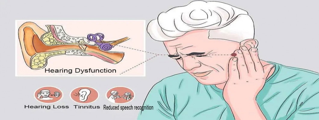 How NMN Prevents and Treats Hearing Loss How NMN Prevents and Treats Hearing Loss