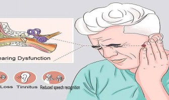 Comment le NMN prévient et traite la perte d'audition Comment le NMN prévient et traite la perte d'audition