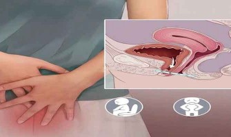 Les puissants bienfaits du NMN : améliorer les troubles du plancher pelvien chez les femmes Les puissants bienfaits du NMN : améliorer les troubles du plancher pelvien chez les femmes