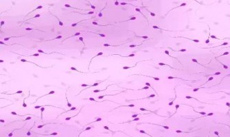 Potential of NMN in Alleviating Male Infertility Induced by Diabetes Potential of NMN in Alleviating Male Infertility Induced by Diabetes